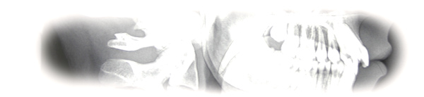 gna